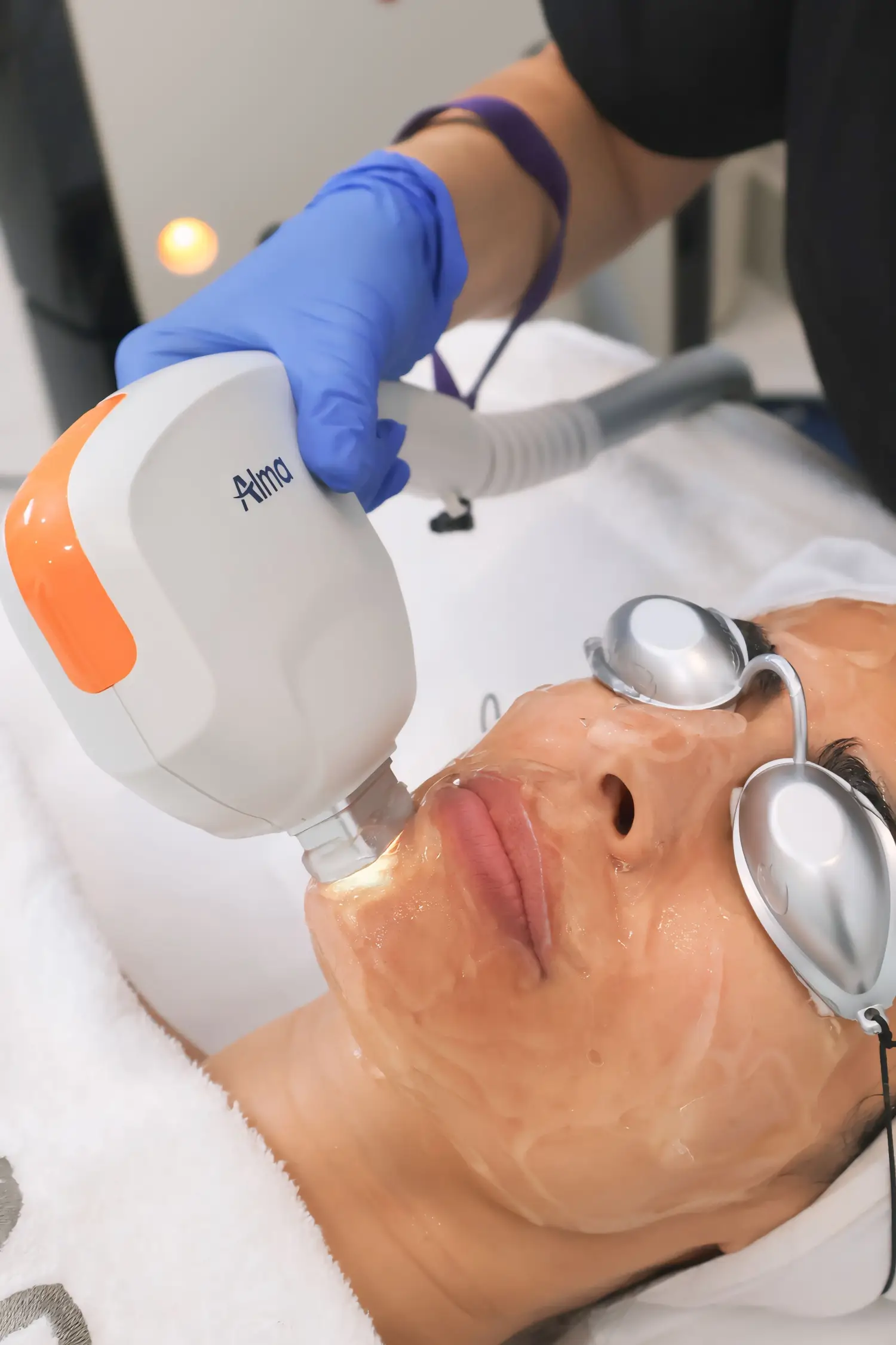 AFT Photo Rejuvenation session at Ivory Aesthetics Clinic