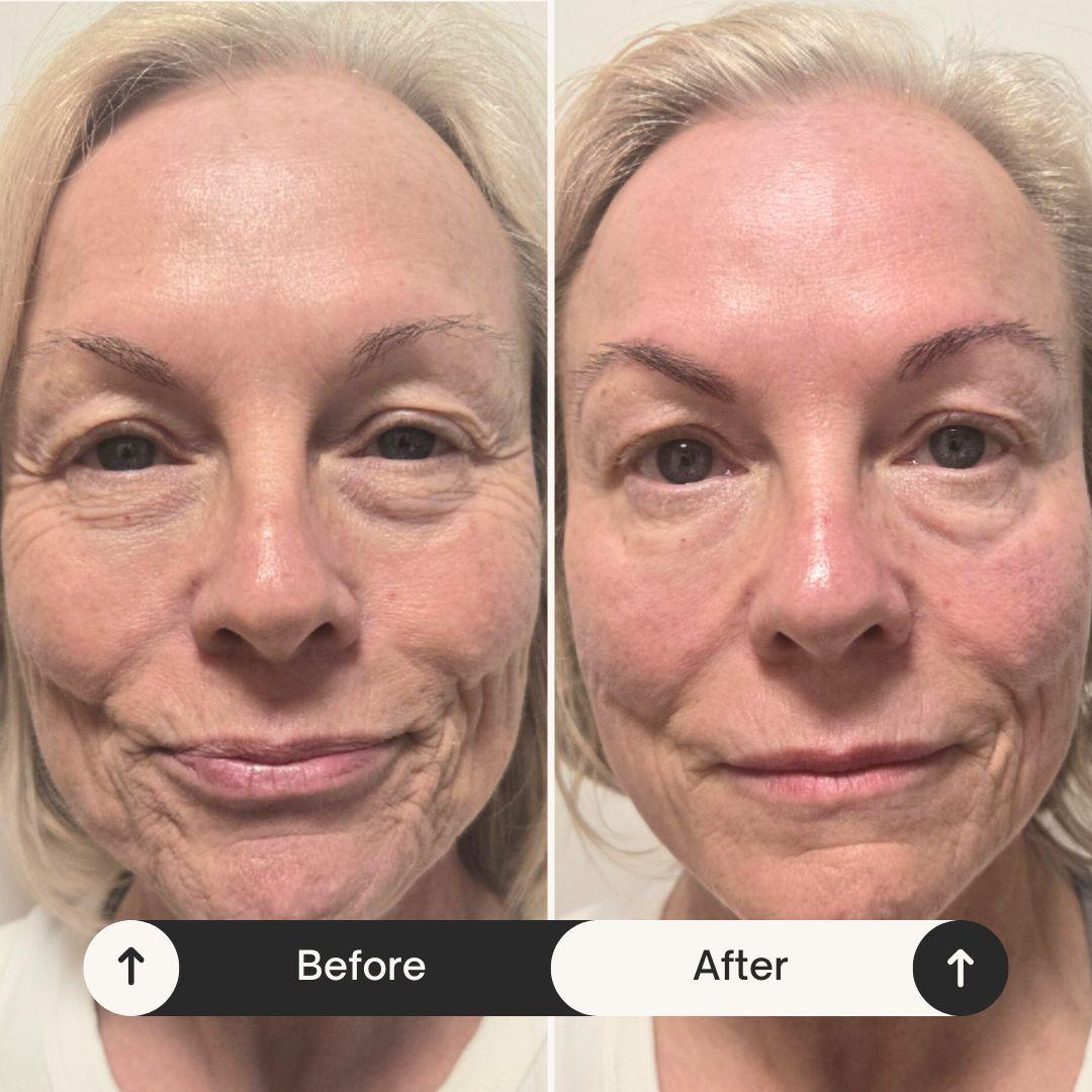 Client transformation