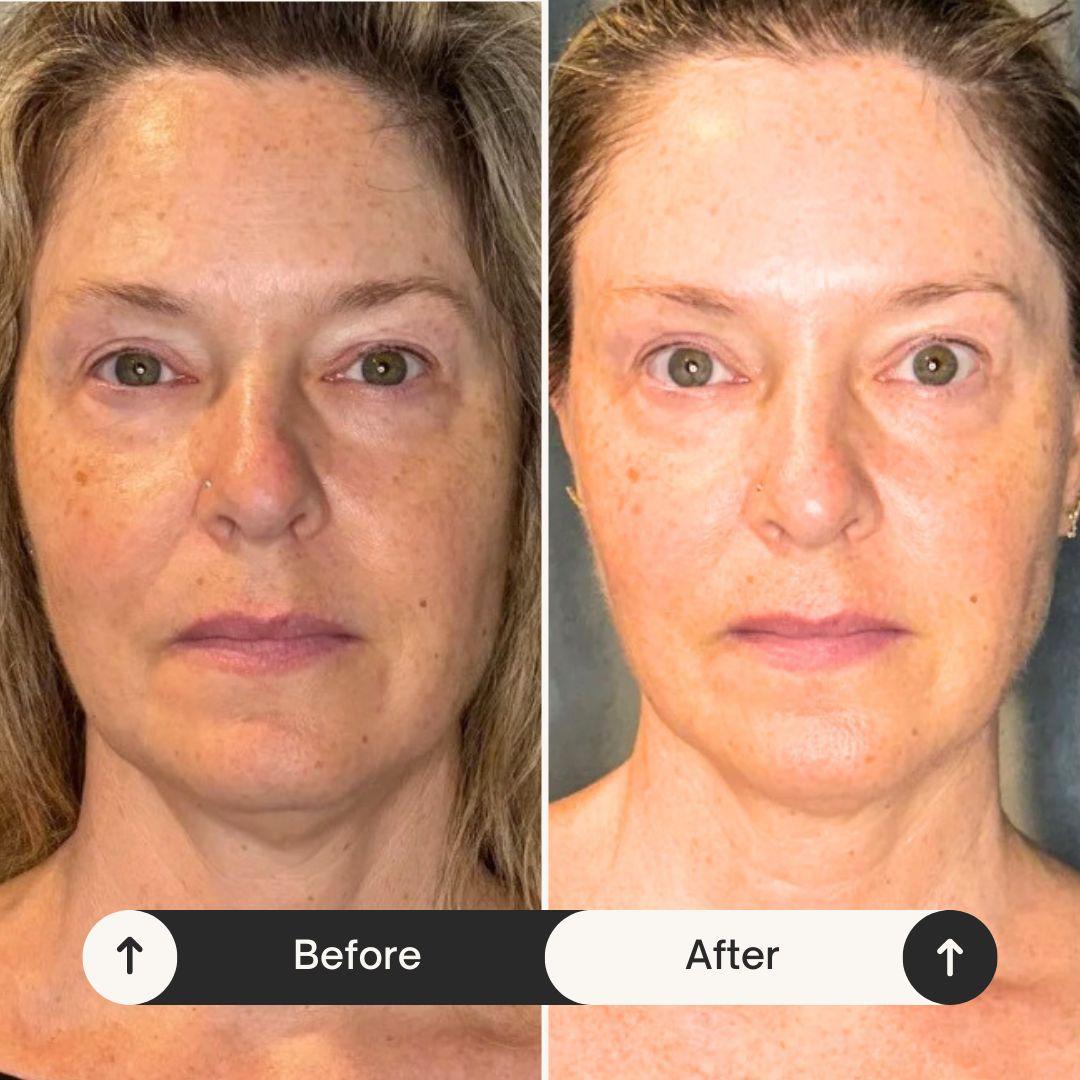 Client transformation