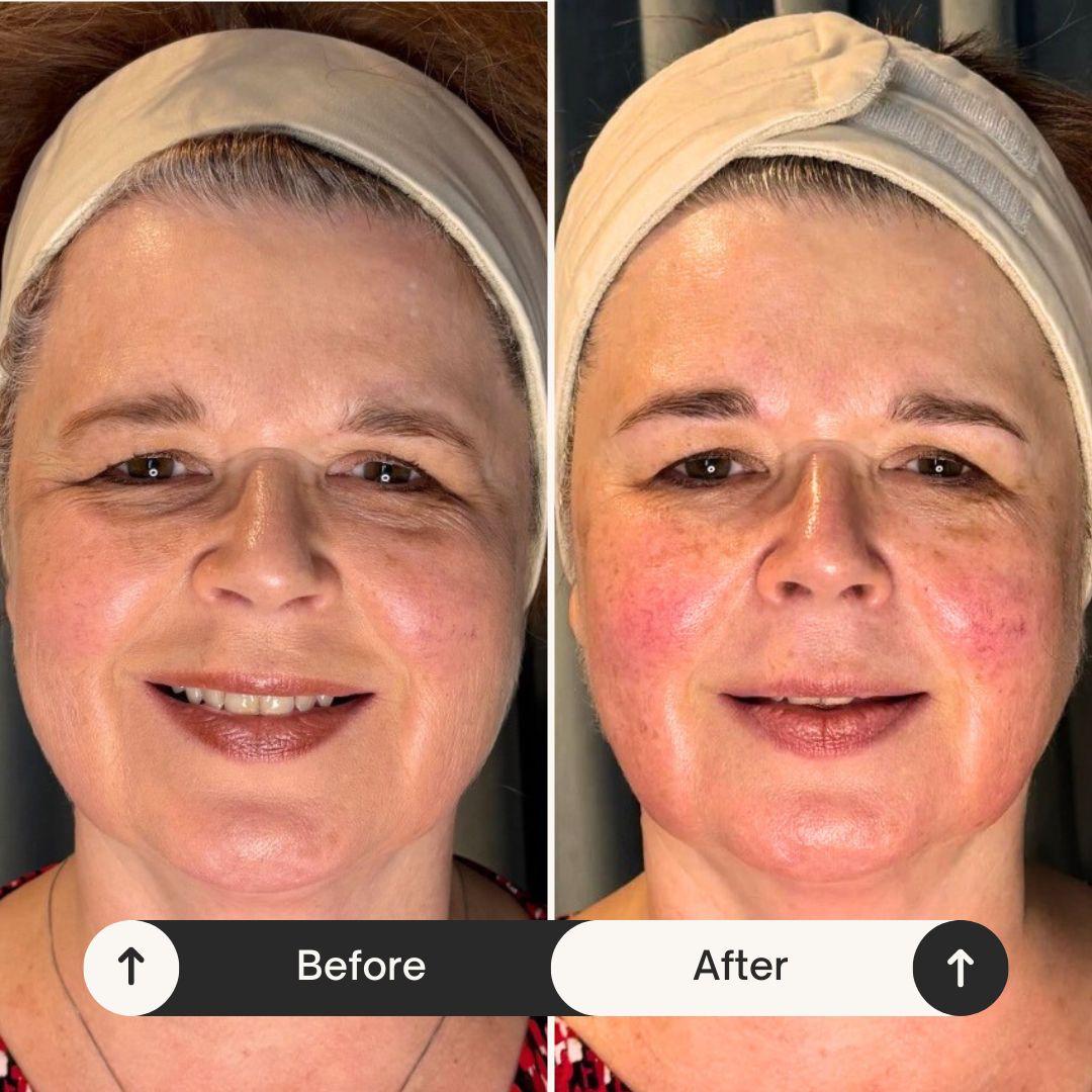 Client transformation