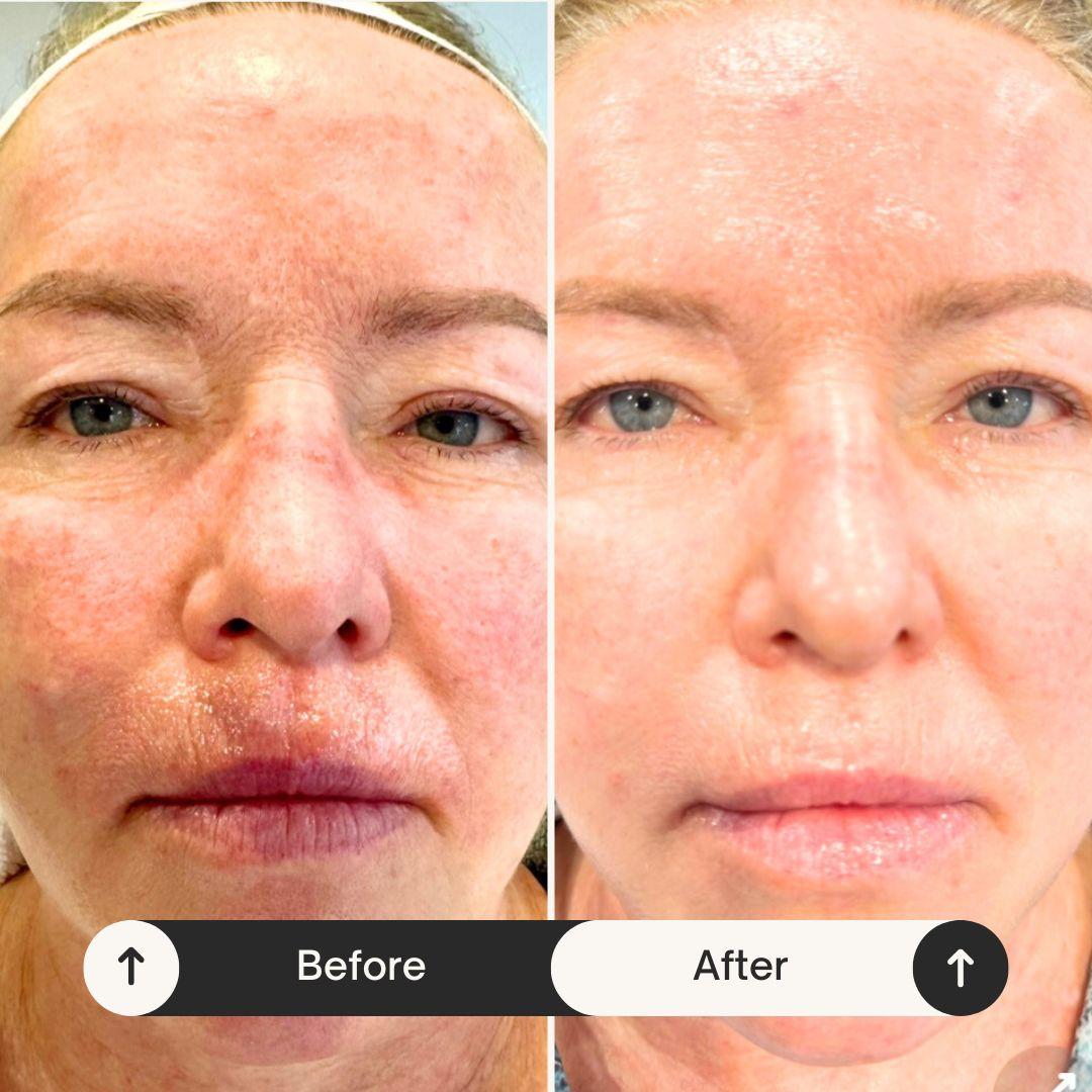 Client transformation