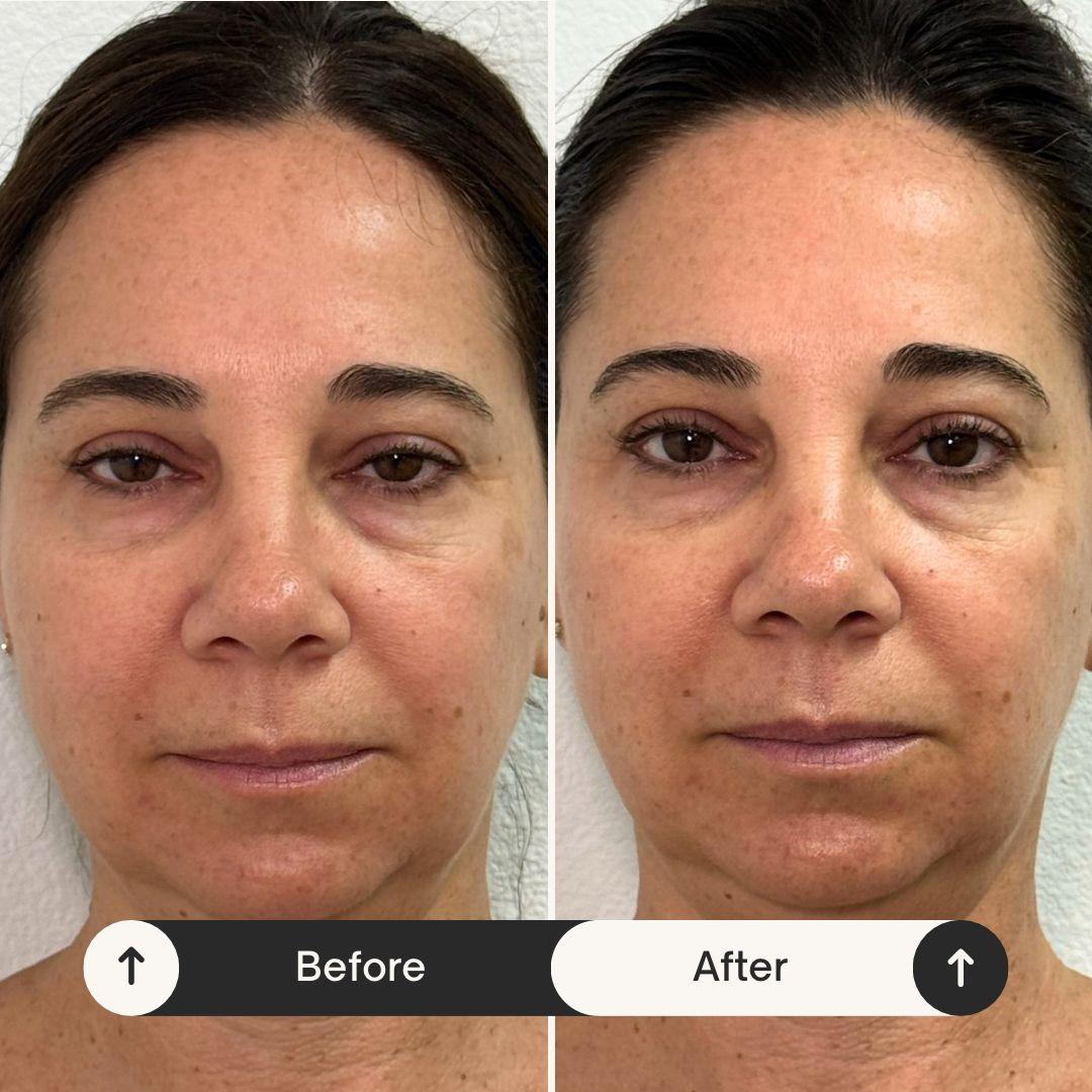 Client transformation