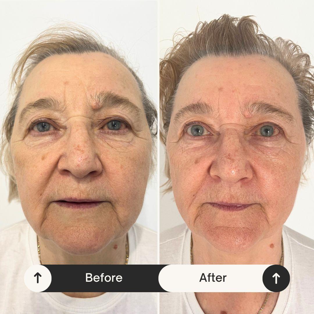 Client transformation