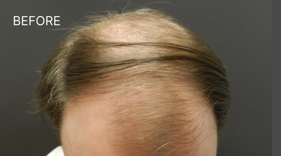 Before Image