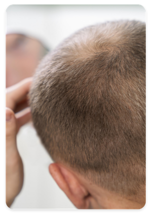 Person with healthy hair