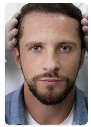 Person with healthy hair